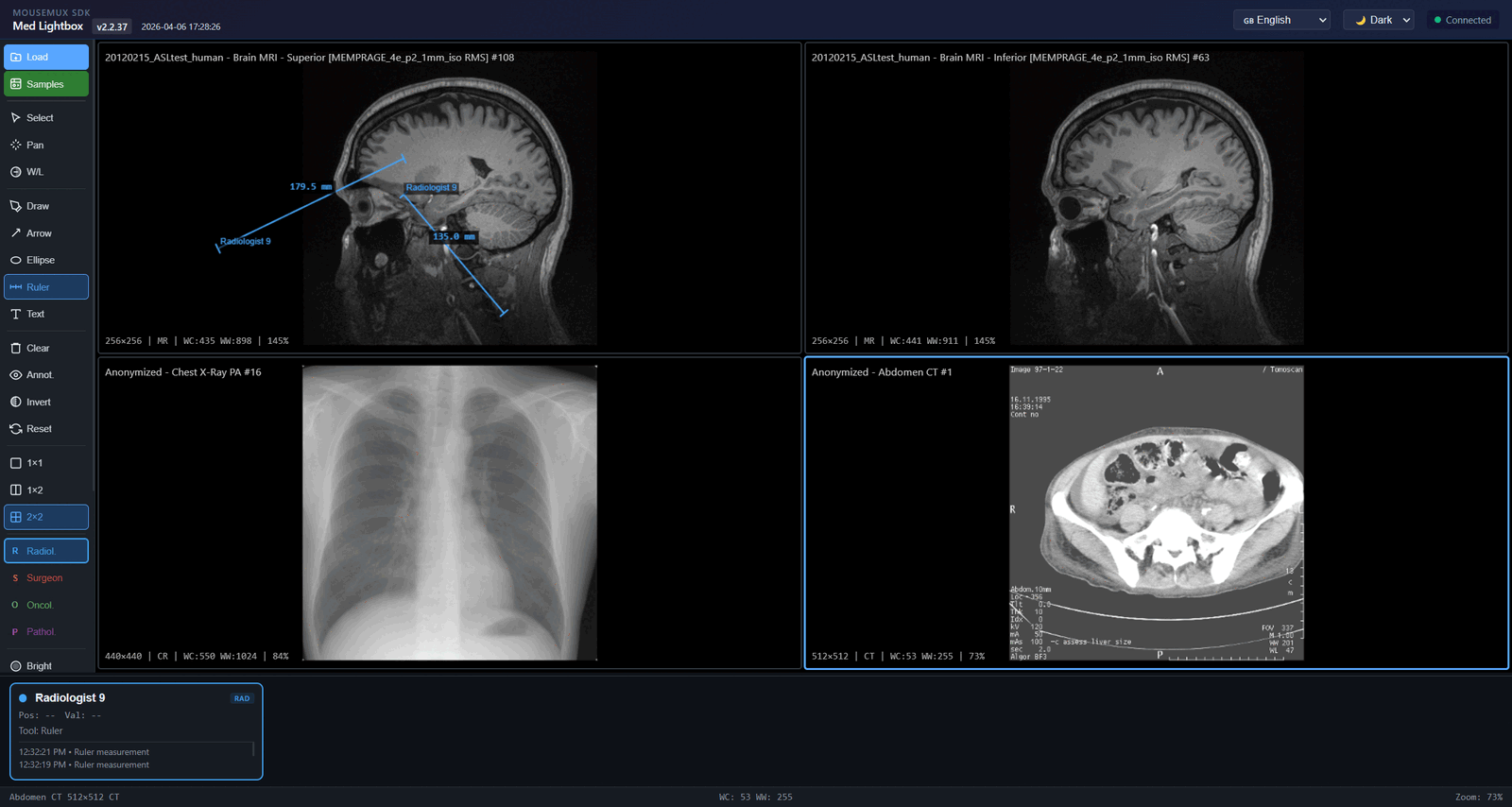 Med Lightbox